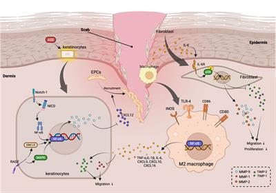 Targeting matrix metalloproteases in diabetic wound healing